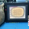 รับซ่อมจอ OMRON NT31-ST123B-V3 อาการ จอไม่ชัด ทั้ง 2 จอ